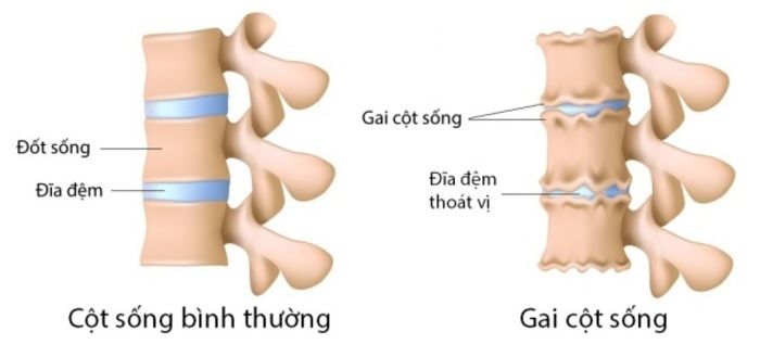 nguyen-nhan-gay-ra-thoai-hoa-dot-song-co-tac-dong-va-yeu-to-quan-trong-2.jpg